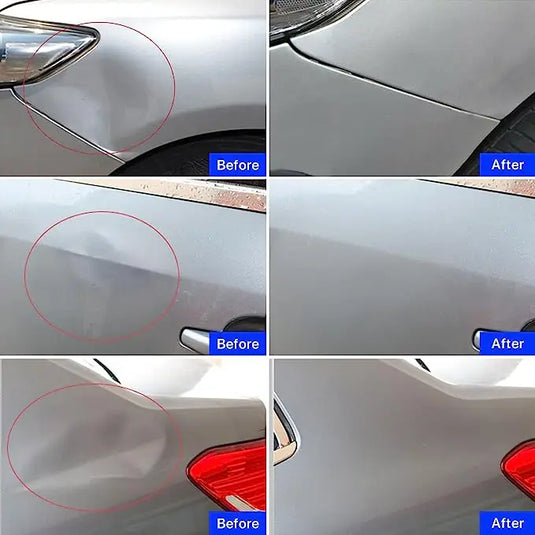 Paintless Dent Repair Kit - Auto Hail Damage Removal with Suction Cups